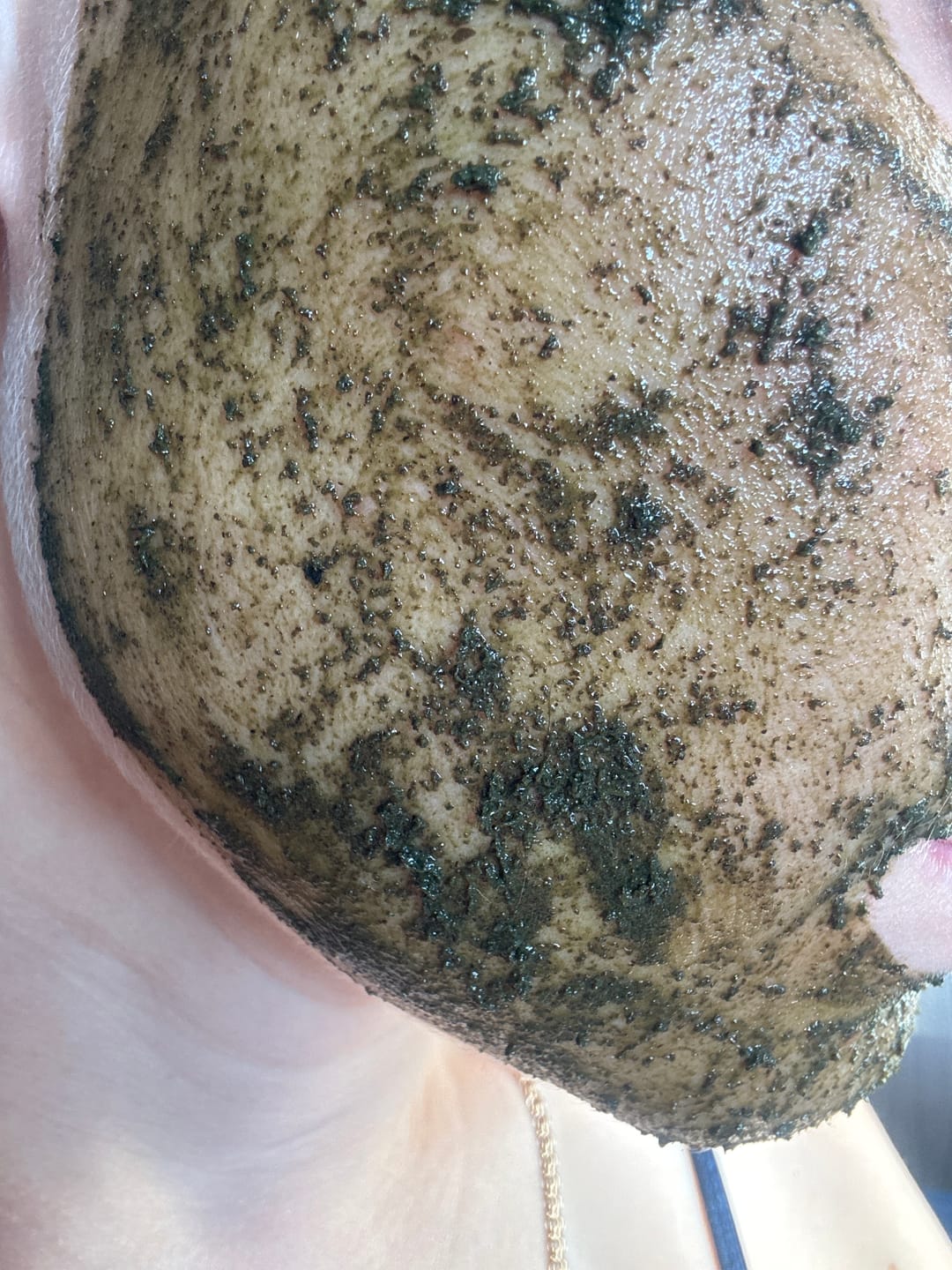 Customer photo review of Attīrošā pīlinga maska ar spīkulām Medi-Peel Herbal Peel Tox PRO