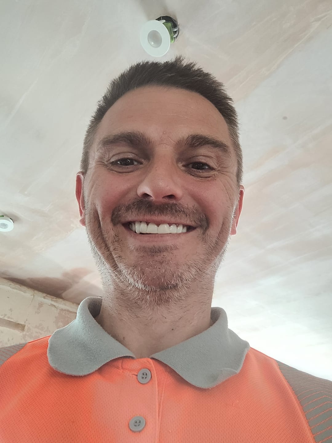 Customer photo review of Click-in Veneers 4.0