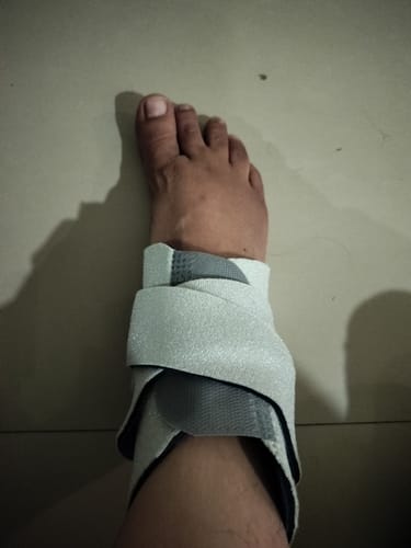 Customer photo review of Neoprene Ankle Support | Provides Optimum Compression & Support to the Ankle (Grey)