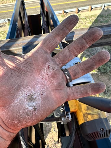 Customer photo review of F-Balm - Premium Anti-aging Tallow Balm - 2 oz.