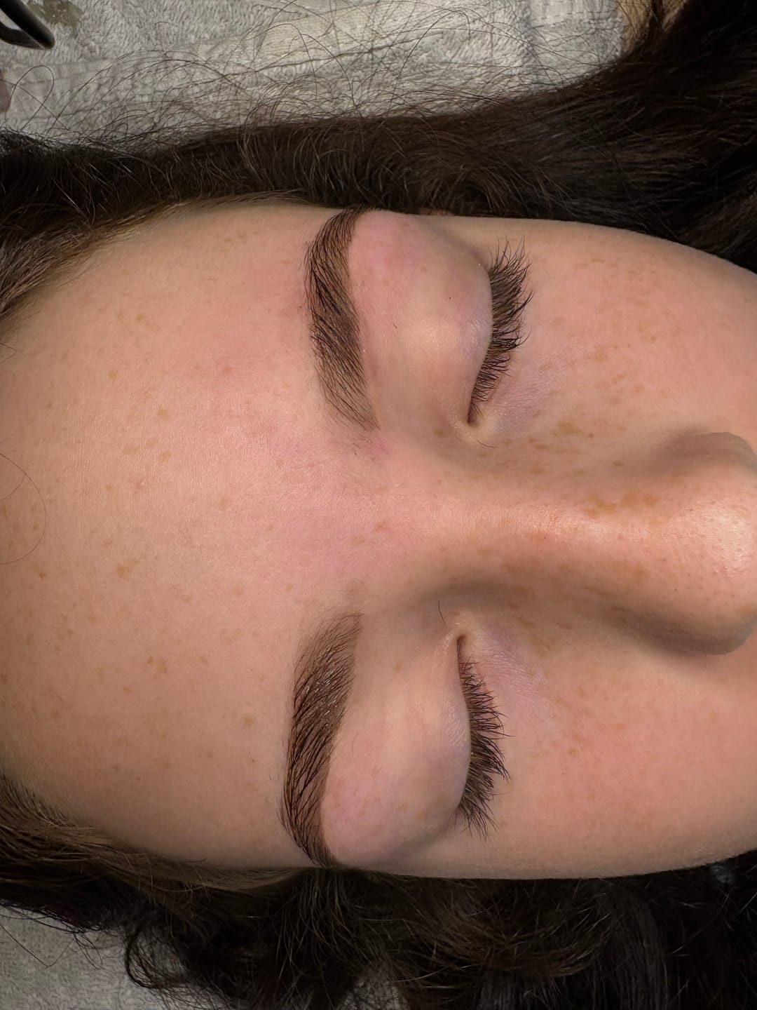 Customer photo review of Skin Preparation