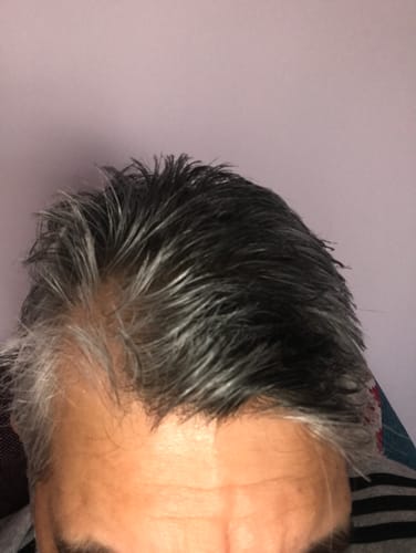 Customer photo review of Seb Natural Calming Serum