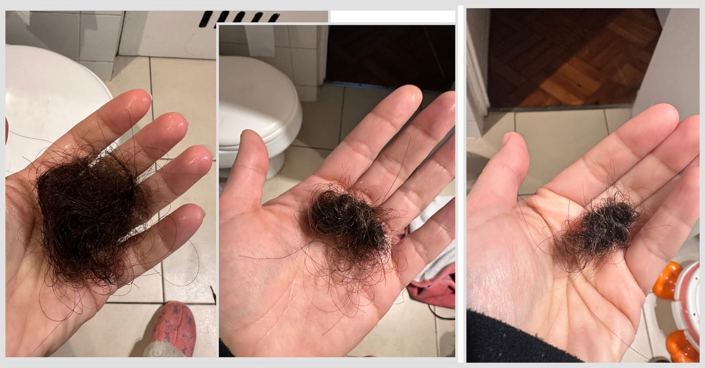 Customer photo review of DUO ANTIcaída CRECIMIENTO INTENSIVO Bomba + Tónico