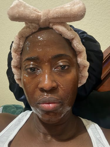 Customer photo review of Collagen Night Wrapping Mask