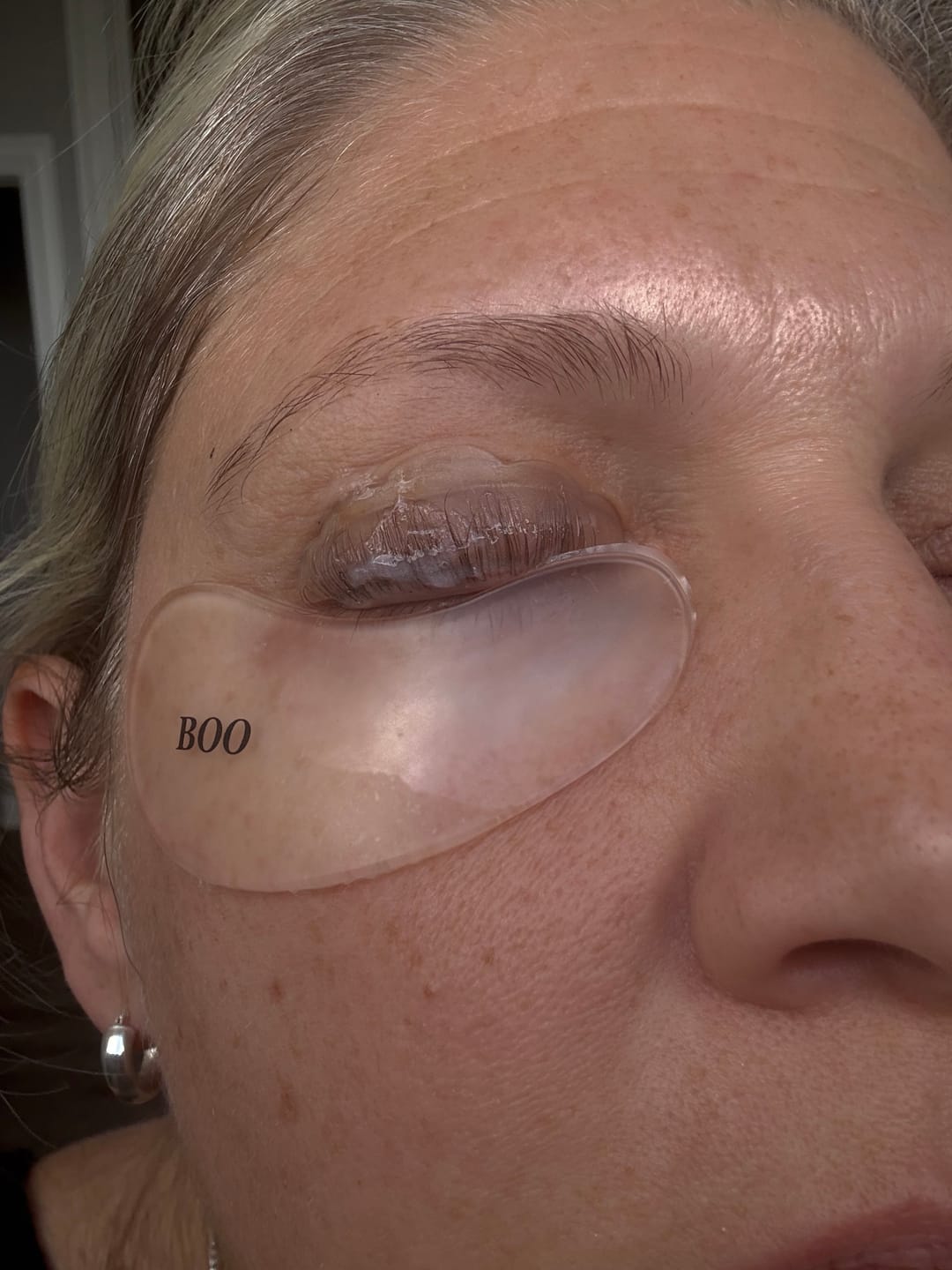Customer photo review of Hypoallergenic Reusable Eye Pads