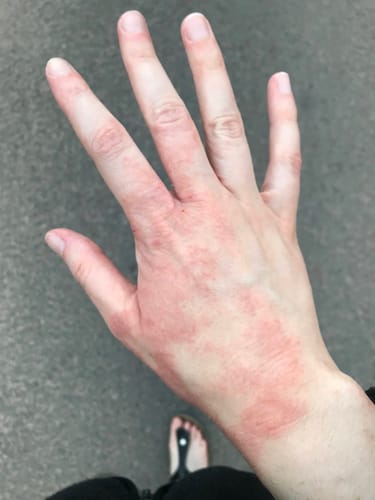 Customer photo review of Multi Strain Biotic