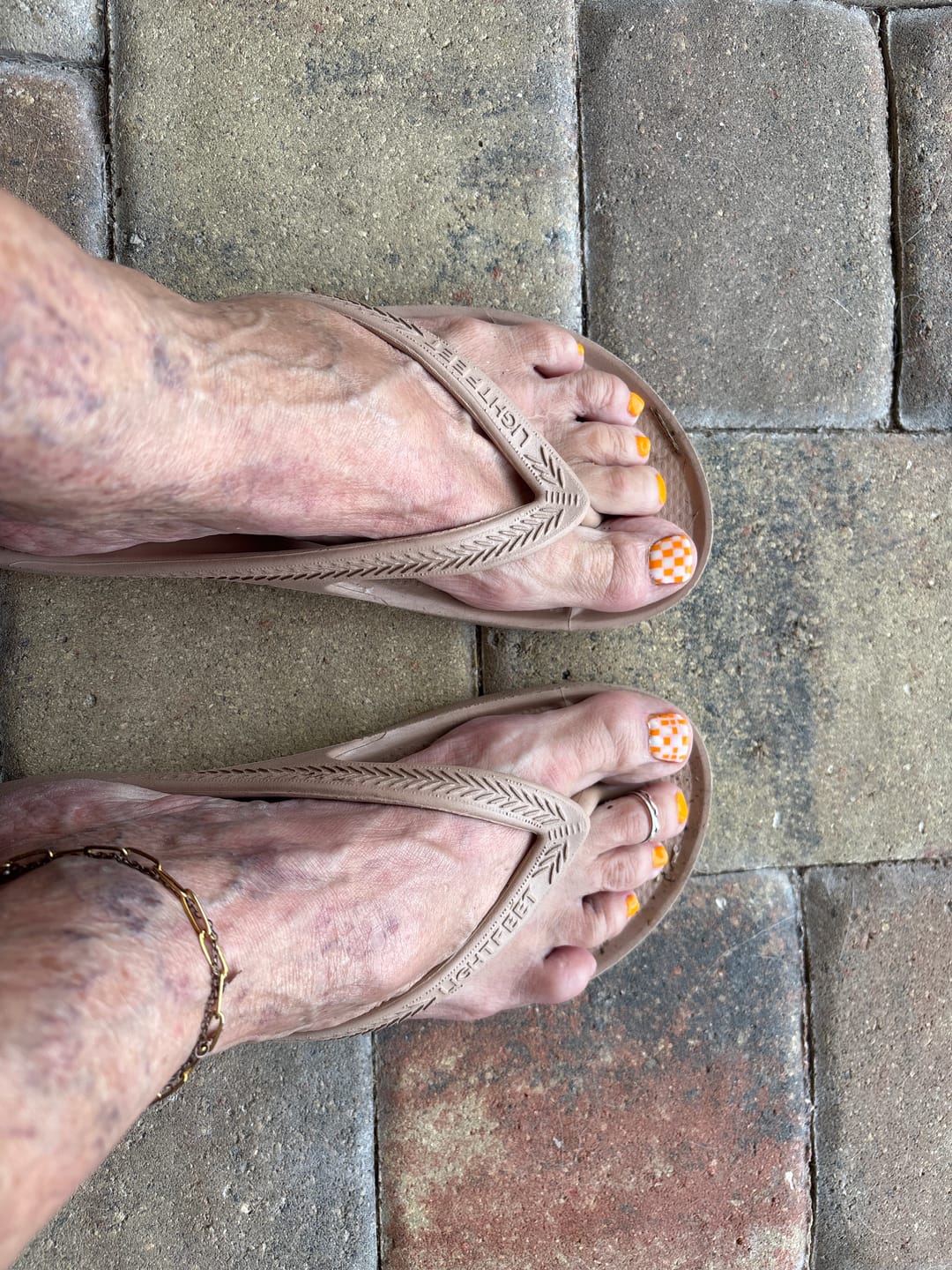 Customer photo review of Peach - Arch Support Flip Flops