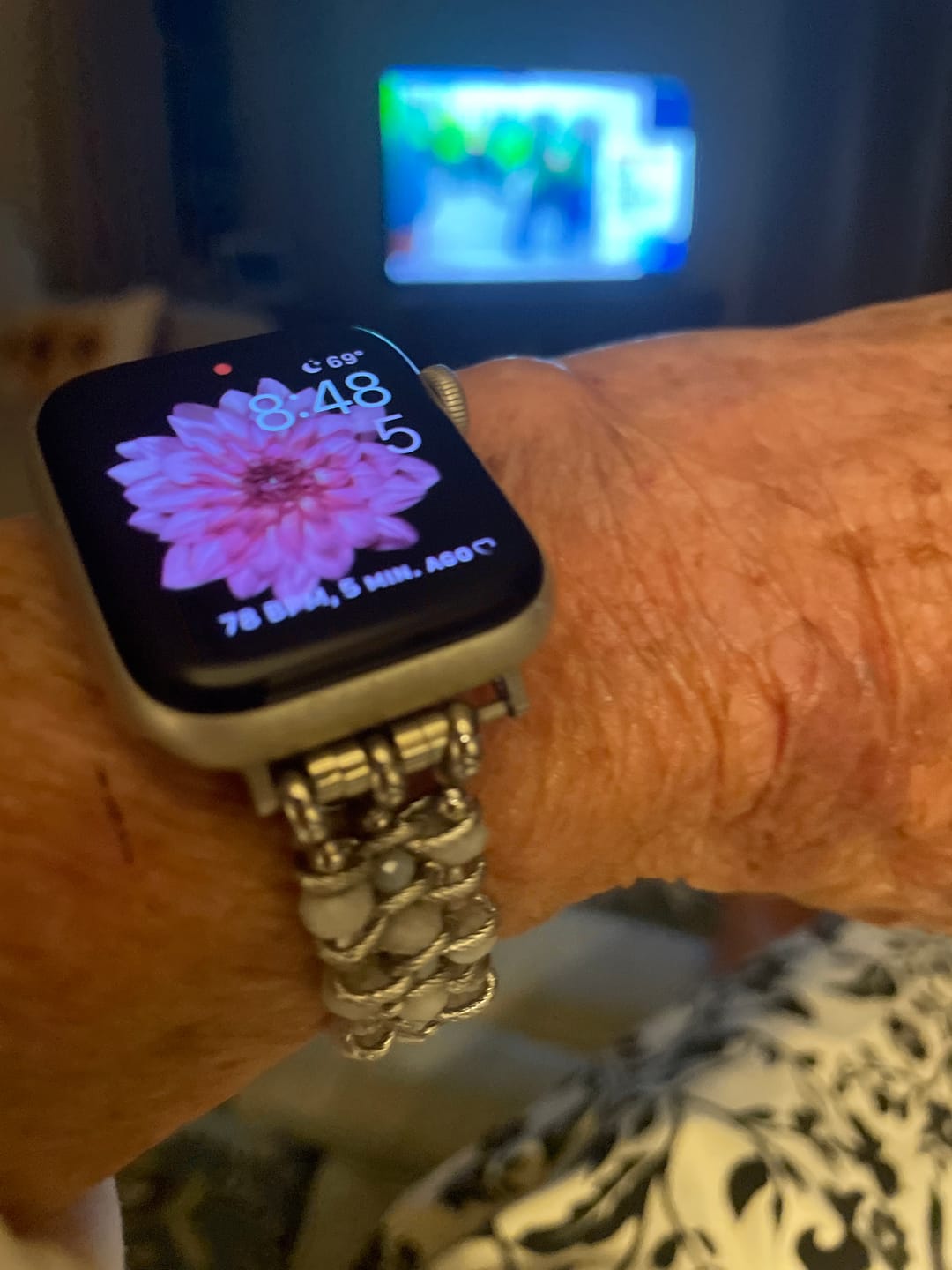 Customer photo review of Moon Mirage Braided Stretch Apple Watch Strap