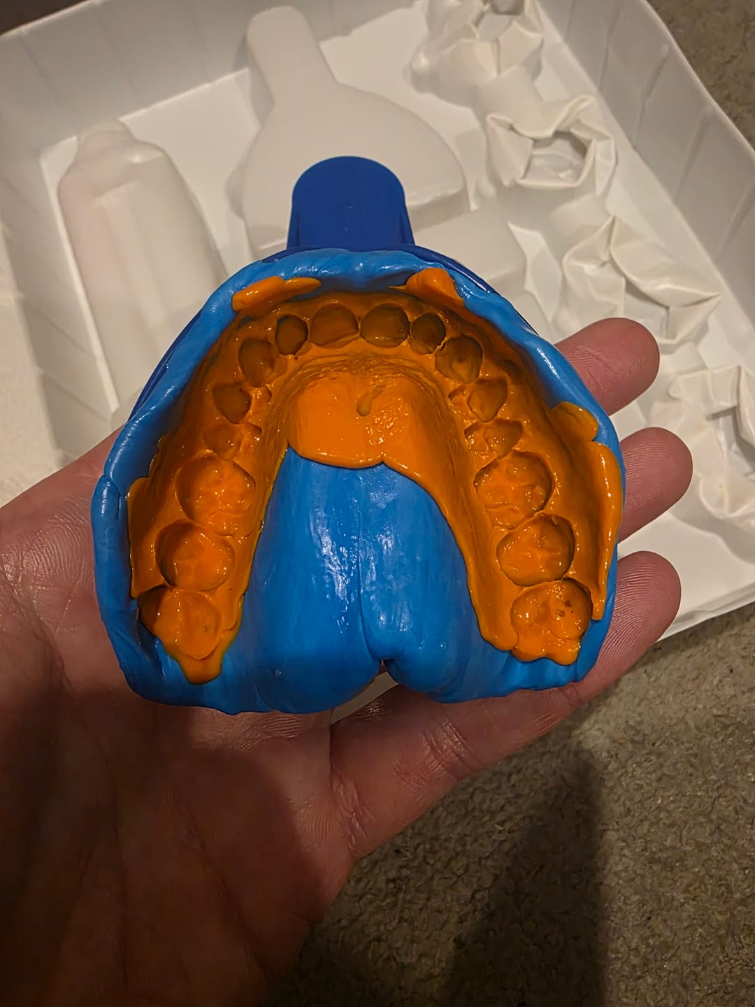 Customer photo review of Upper Impression Kit