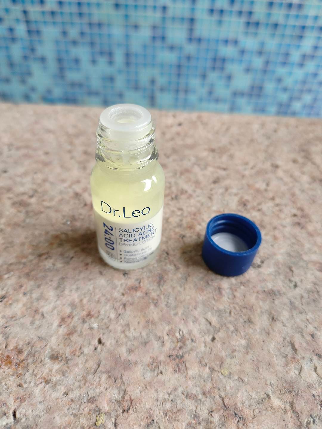 Customer photo review of Loción para el tratamiento del acné con ácido salicílico