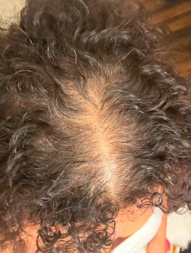 Customer photo review of Ultimate Transformation Bundle- Entire hair product line at $50 off! FREE SHIPPING