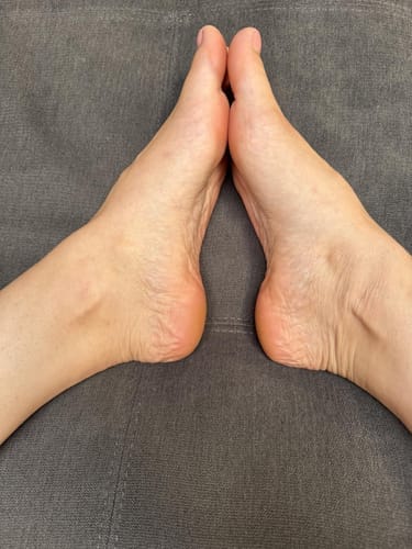 Customer photo review of ™Pedi - מכונה להסרת עור יבש וסדקים בכפות הרגליים