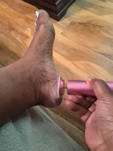 Customer photo review of ™Pedi - מכונה להסרת עור יבש וסדקים בכפות הרגליים