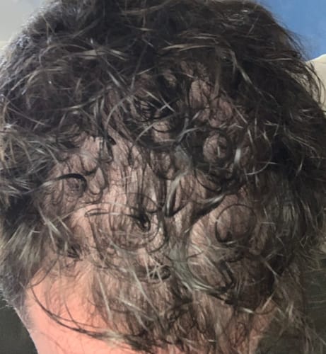 Customer photo review of Pack d’Odin | Kit Renaissance Capillaire