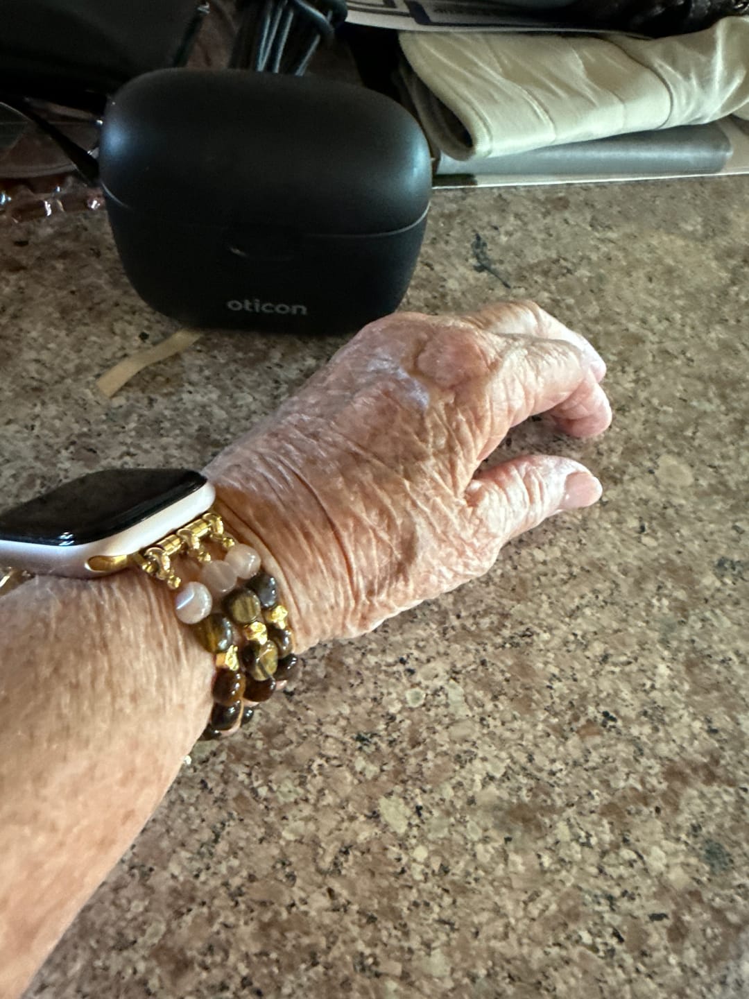Customer photo review of Golden Glowcore Stretch Apple Watch Strap