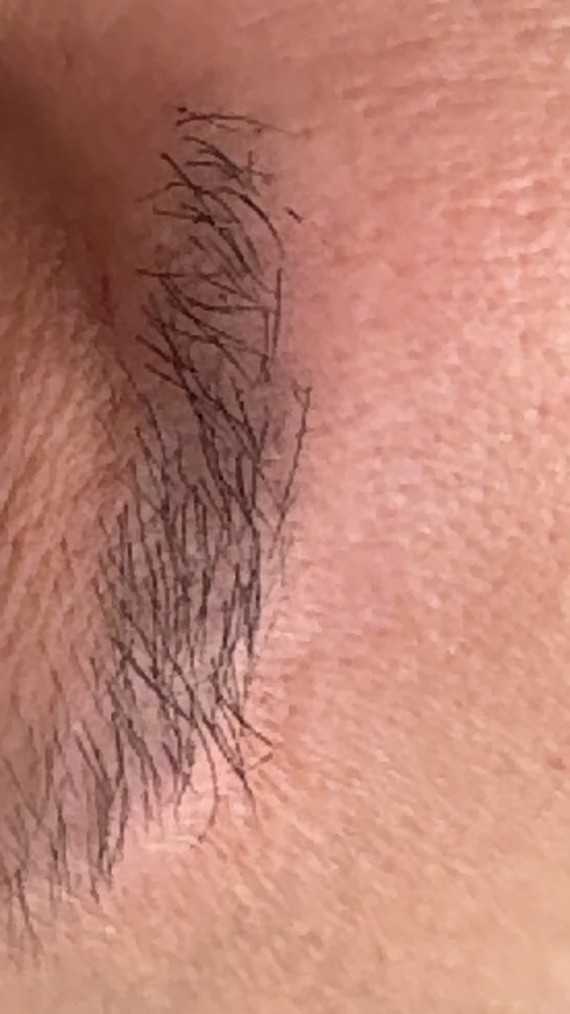 Customer photo review of IZABELL ROLLER - Roller for eyebrow regrowth