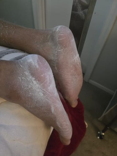Customer photo review of ™Pedi - מכונה להסרת עור יבש וסדקים בכפות הרגליים