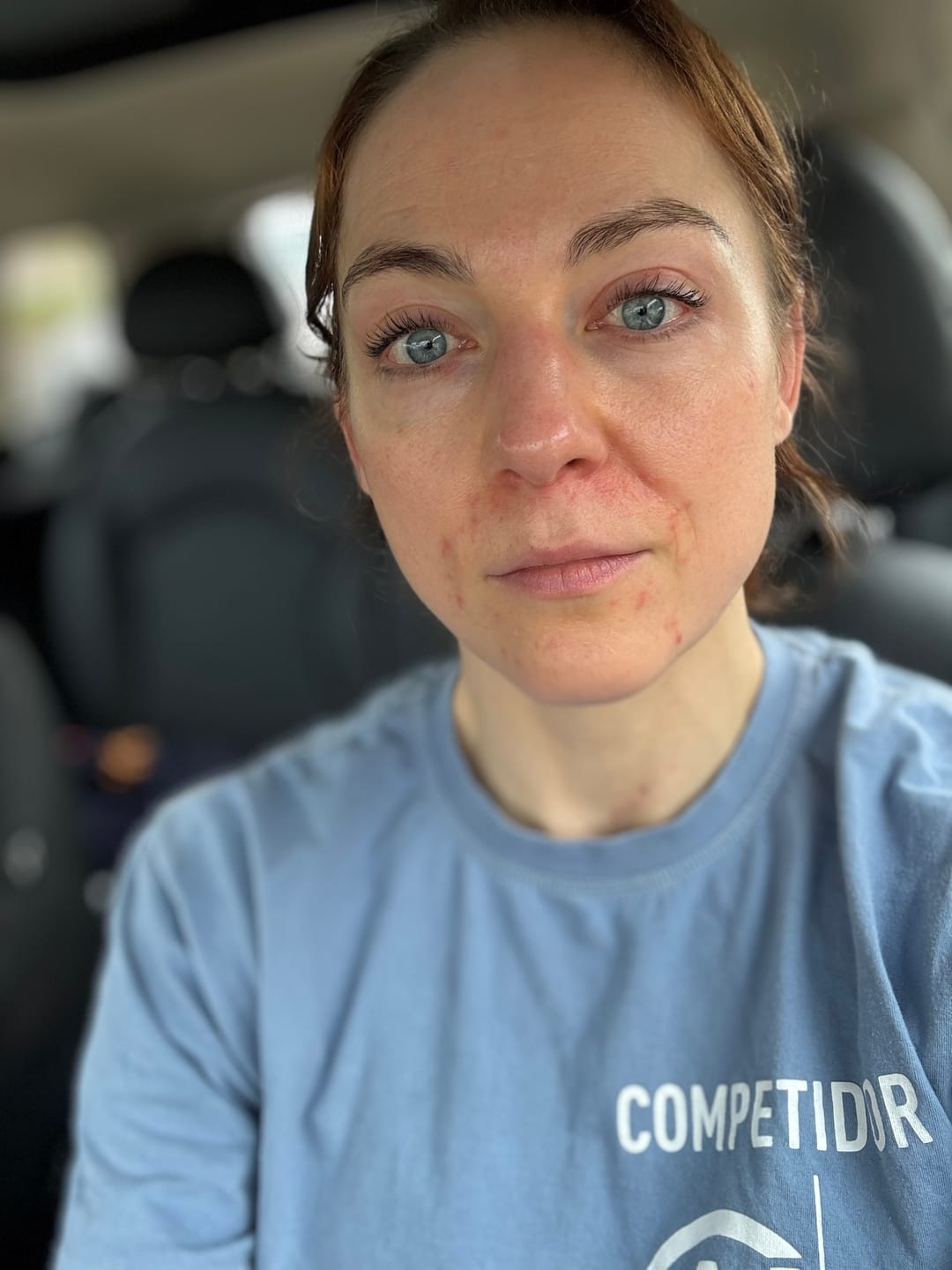 Customer photo review of Total Cranarchy Multi-Use Balm