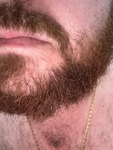 Customer photo review of Seb Natural Calming Serum