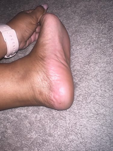 Customer photo review of ™Pedi - מכונה להסרת עור יבש וסדקים בכפות הרגליים
