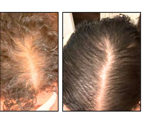 Customer photo review of Ultimate Transformation Bundle- Entire hair product line at $50 off! FREE SHIPPING