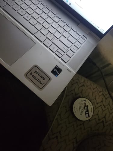 Customer photo review of F-Balm BULK (10 pack)