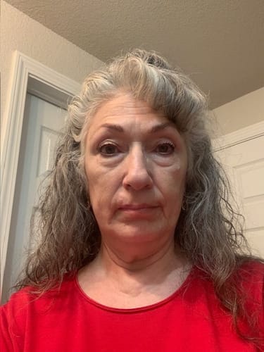 Customer photo review of Face & Neck Deluxe System