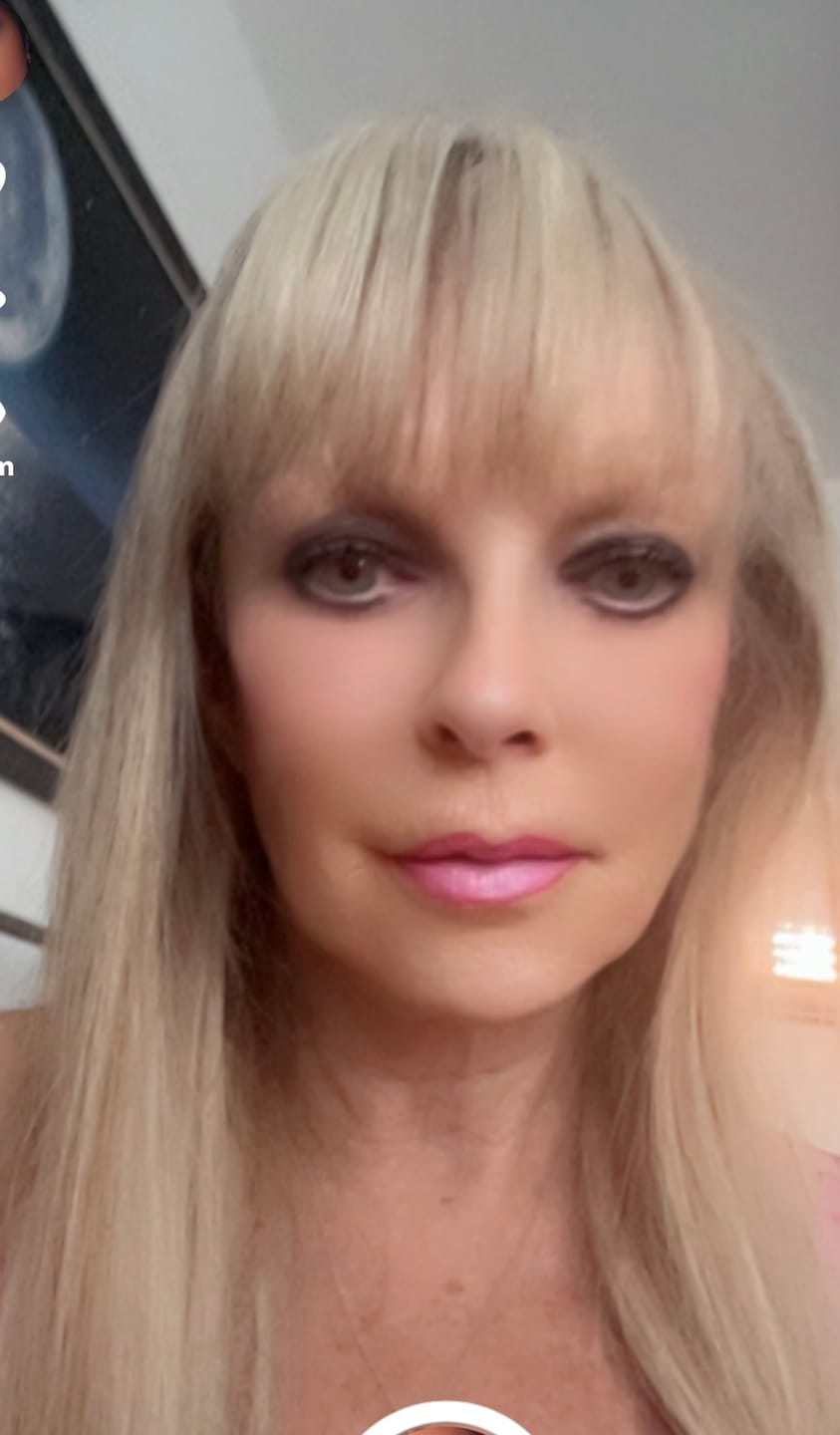 Customer photo review of Easi-iTips Professional Hair Extensions 18 Inch