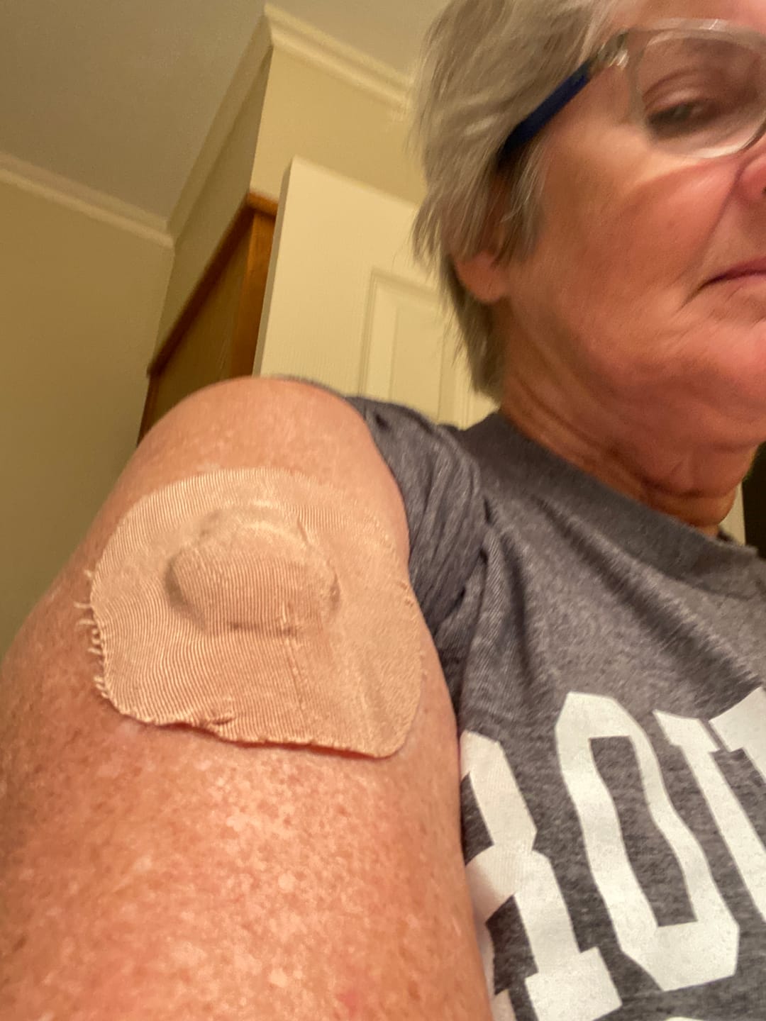 Customer photo review of Skin Grip Original - Medtronic Guardian/Enlite Adhesive Patches