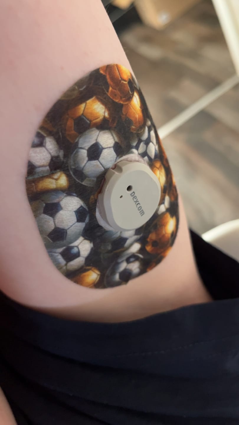 Customer photo review of Fotboll CGM-sensor overpatches för Dexcom G7 för en riktig målskytt