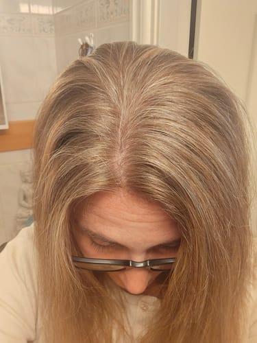 Customer photo review of Sunkissed Starter Kit