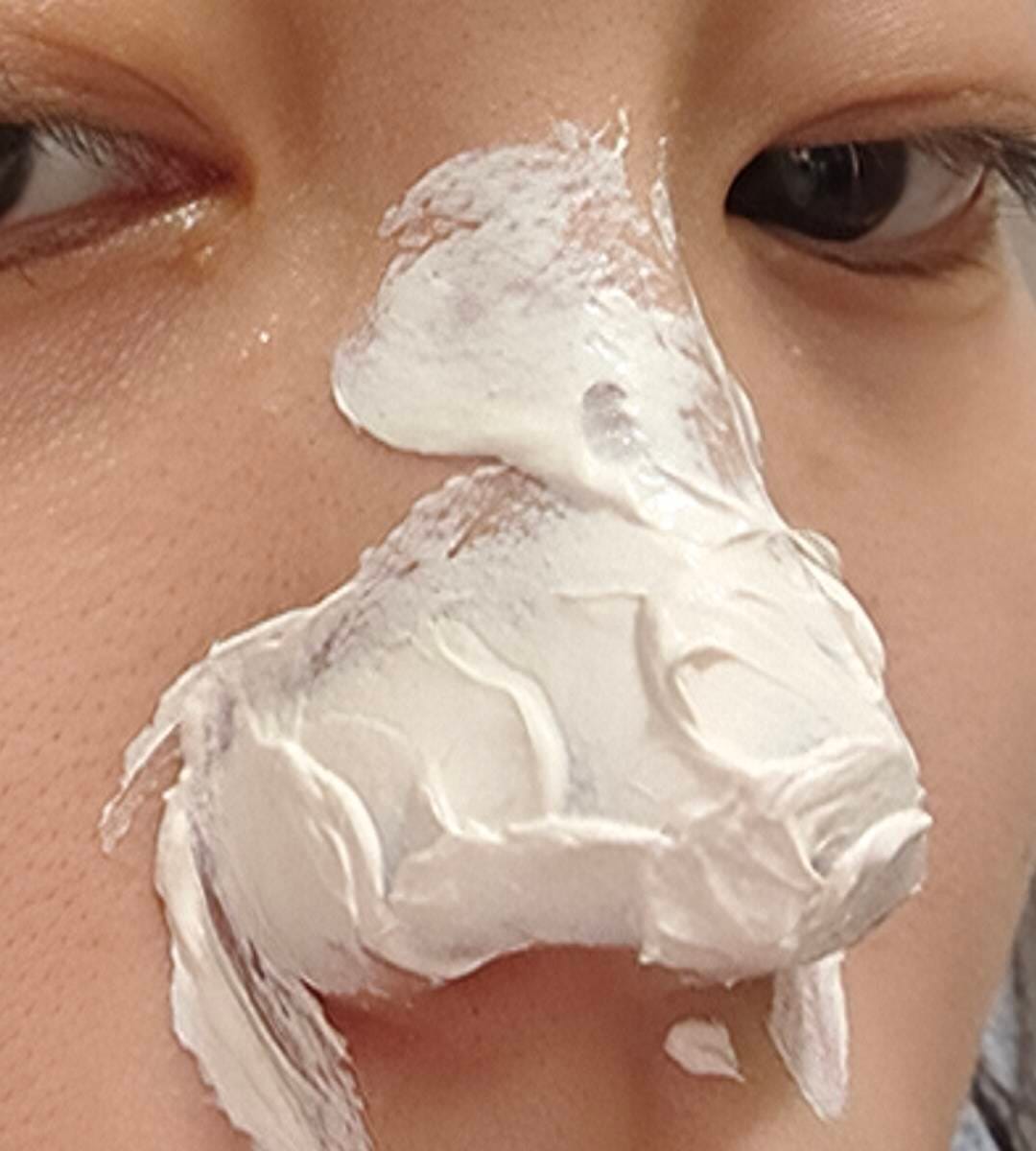 Customer photo review of Mascarilla de Arcilla con 3 Ácidos para Limpieza Profunda de Poros