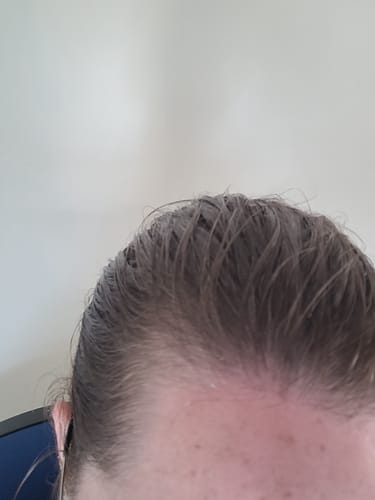 Customer photo review of Seb Natural Calming Serum