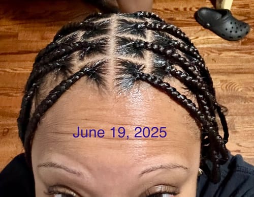 Customer photo review of Hair ReGrowth Serum (Squeeze Bottle)