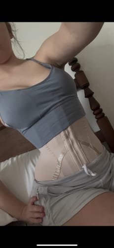 Customer photo review of 2002 Ultra Snatching Waist Trainer