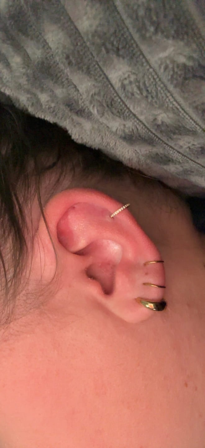 Customer photo review of Zircon Clicker | Nasen- & Ohrpiercing