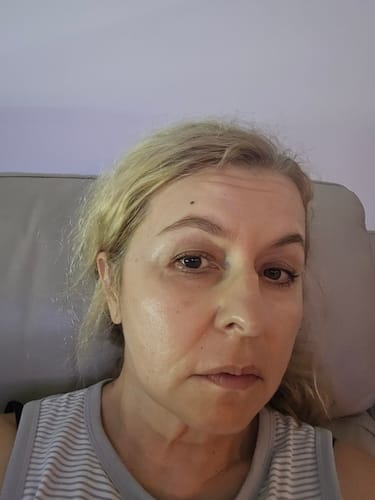 Customer photo review of The Micro Infusion System™