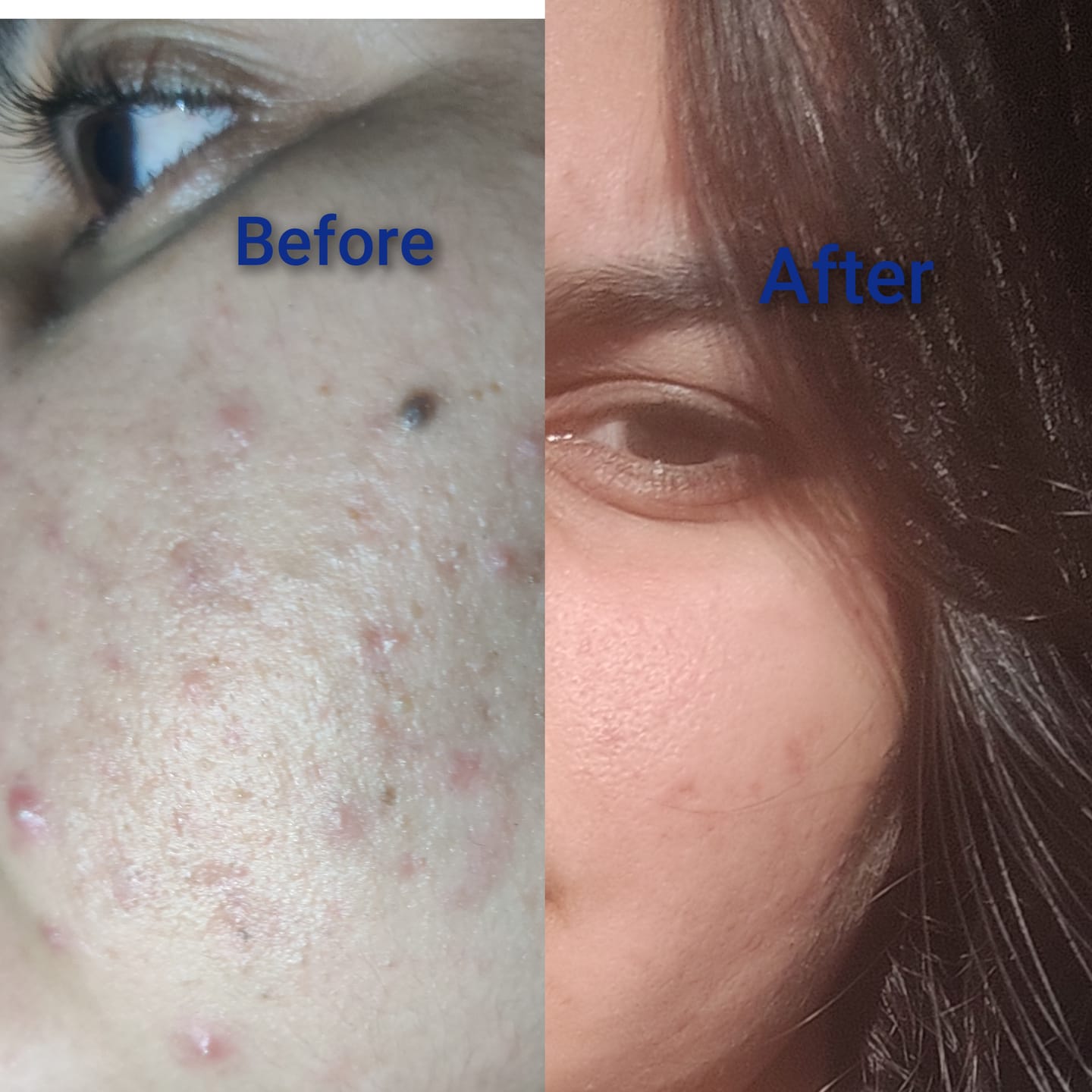 Customer photo review of Spectra Block Kids Spf50