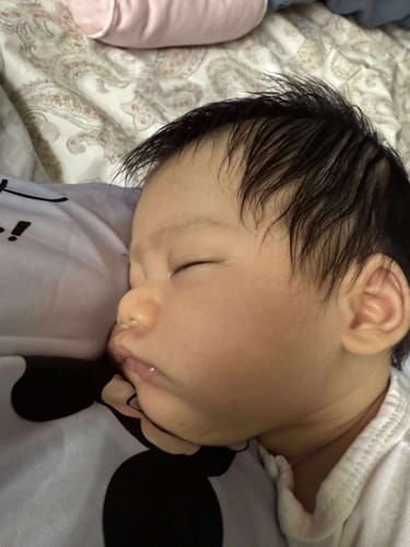 Customer photo review of All Over Ointment Eczema Treatment