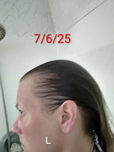 Customer photo review of Glov Hair Regrowth System