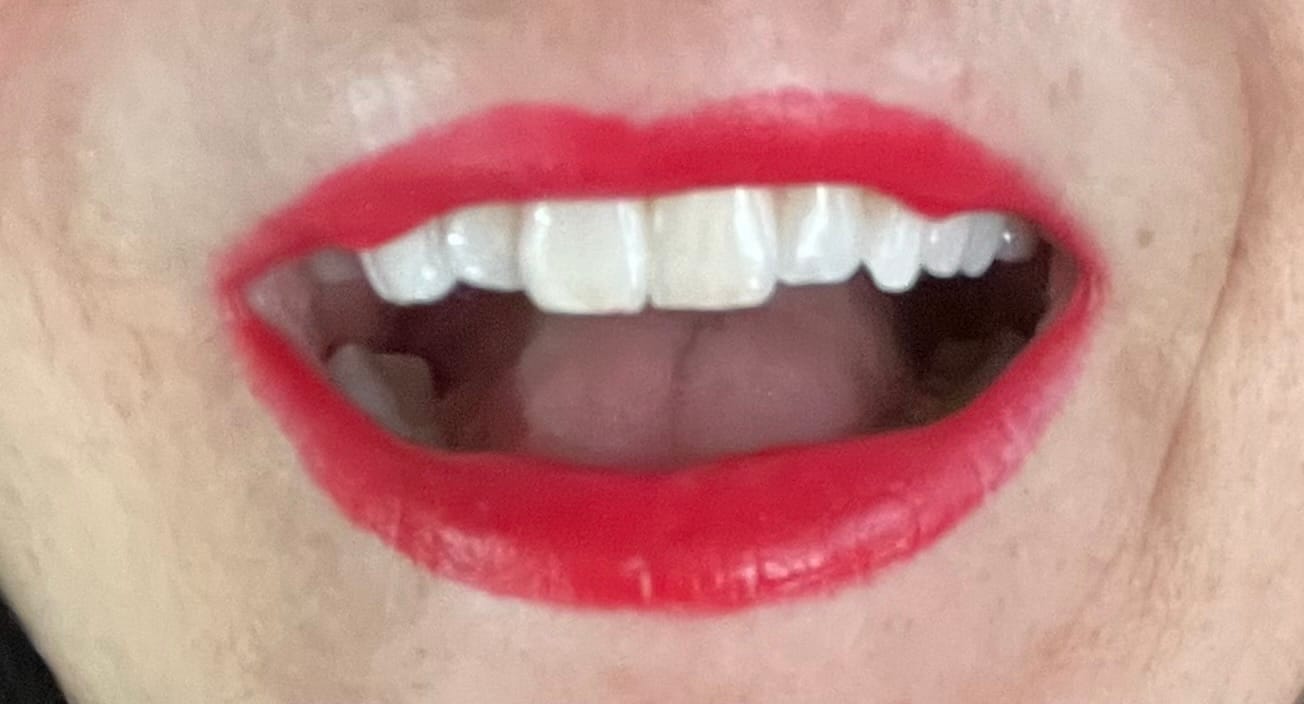 Customer photo review of Gel Violet Blanchissant Kauka Smile