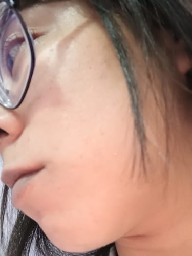 Customer photo review of Set antiacné de 3 pasos (Mascarilla de arcilla + Loción secante + Limpiador)