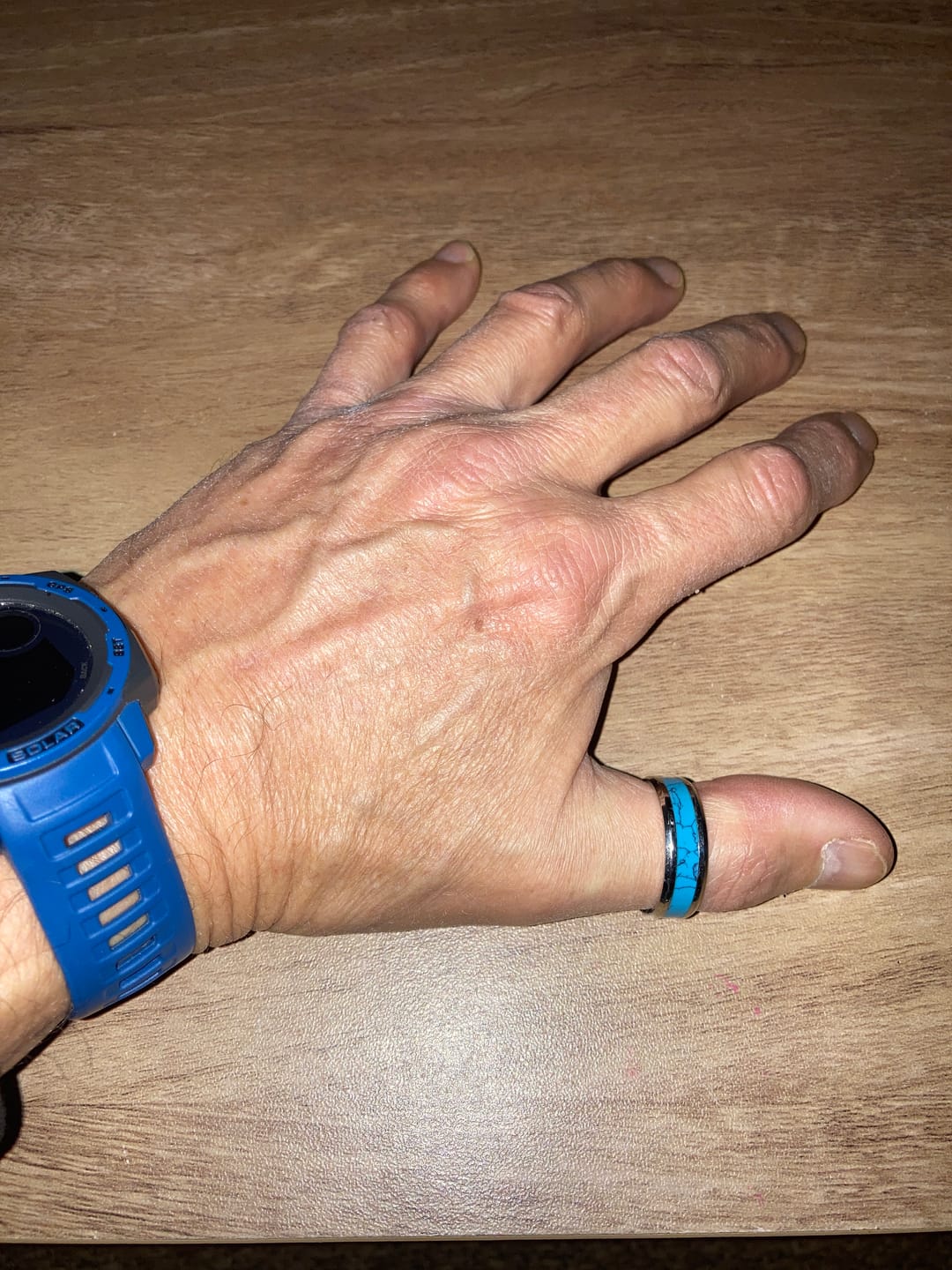 Customer photo review of TURQUOISE BAND.