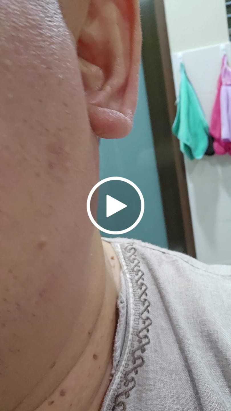 Customer video review of RCV PRO – Barrier Repair for Eczema, Psoriasis and Sensitive skin