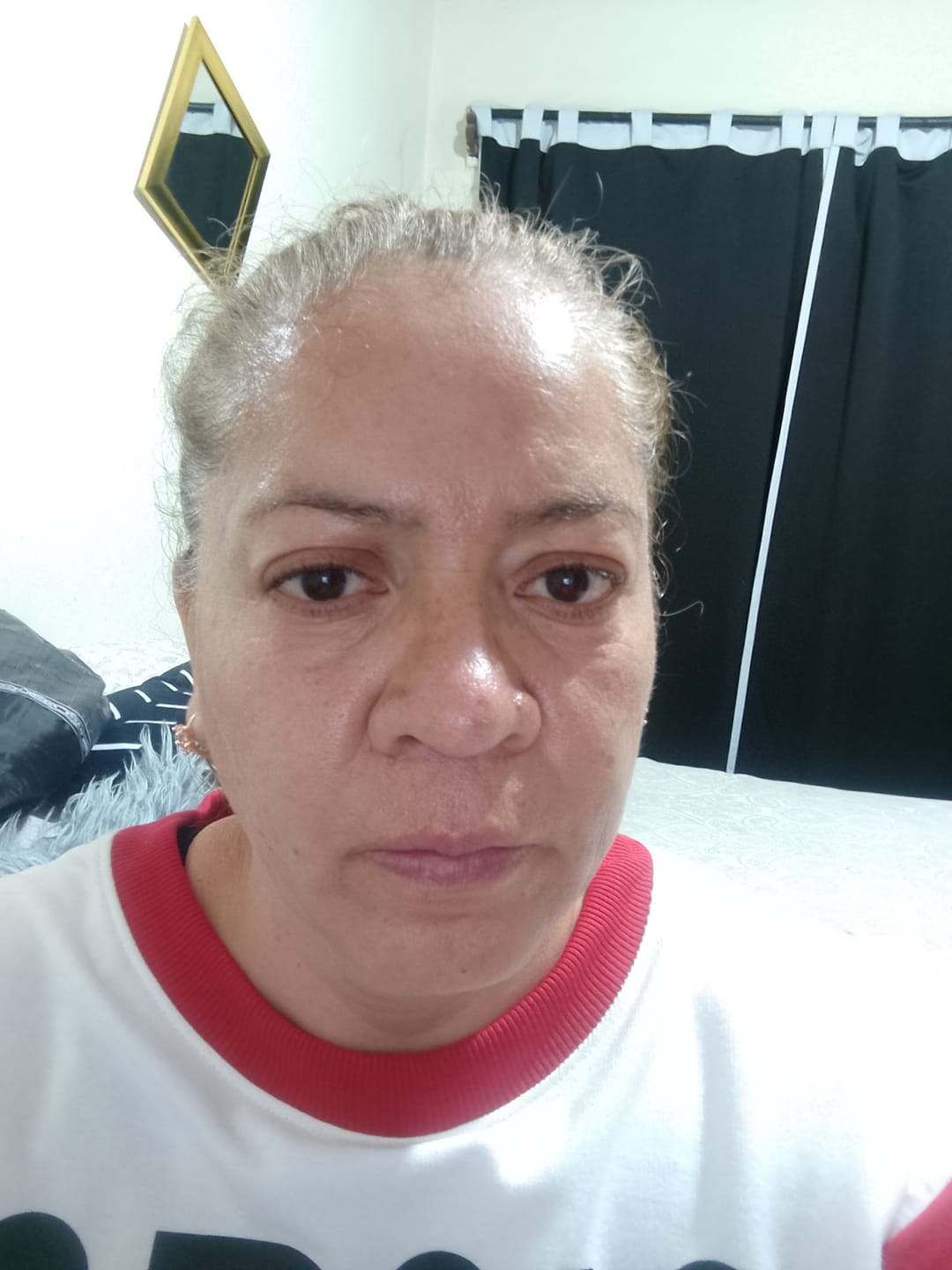 Customer photo review of Mascarilla de Arcilla con 3 Ácidos para Limpieza Profunda de Poros