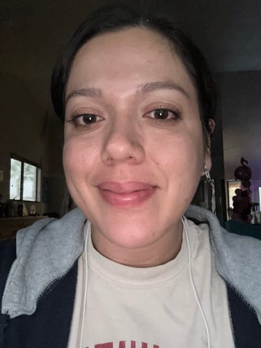 Customer photo review of Pore Detox & Oil Control Set (Cleanser + Clay Mask)