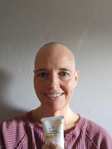 Customer photo review of Chemo Cream for Scalp