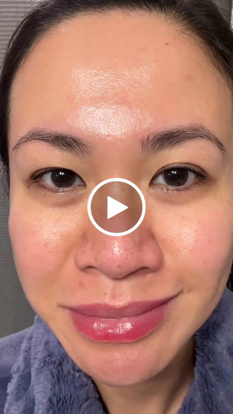 Customer video review of Dr. Pen Hydra H5 Microneedling BB Glow Pen – Microcurrent & Serum Infusion for Professional & Home Use
