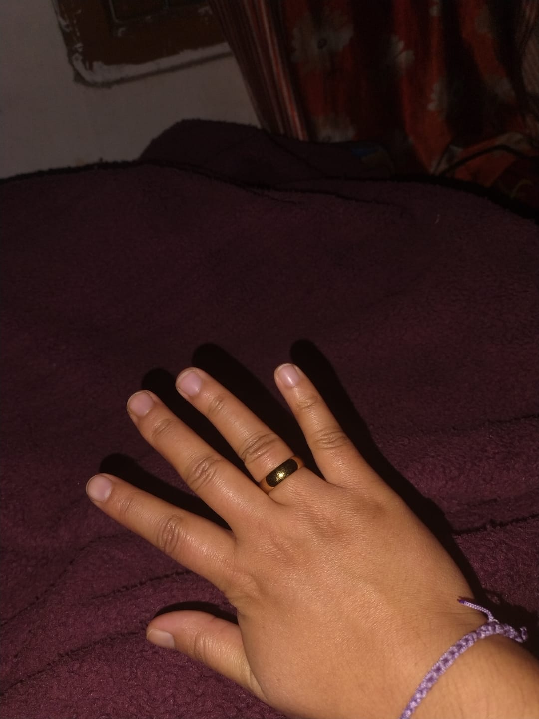 Customer photo review of Bold Gleam Classic Dome Ring