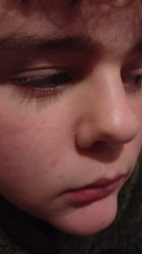 Customer photo review of Seb Natural Calming Serum
